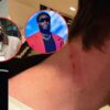 Photos Show Victim’s Injuries in Alleged Gucci Mane Robbery